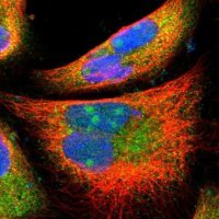 Anti-PFDN1 antibody produced in rabbit