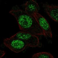 Anti-PGAM1 antibody produced in rabbit 