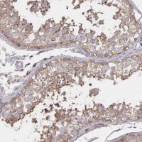 Anti-PGAP2 antibody produced in rabbit 
