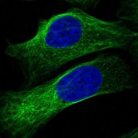 Anti-PGAP2 antibody produced in rabbit 