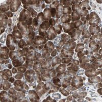 Anti-PGBD1 antibody produced in rabbit