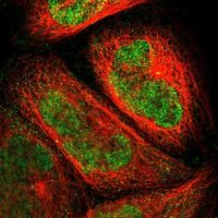 Anti-PGBD1 antibody produced in rabbit