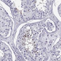 Anti-PGK2 antibody produced in rabbit 