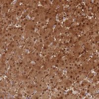 Anti-PGM1 antibody produced in rabbit HPA046329-100UL
