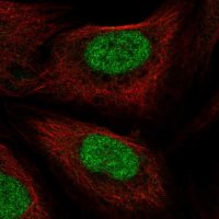 Anti-PHAX antibody produced in rabbit HPA059630-100UL