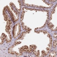 Anti-PHC2 antibody produced in rabbit 