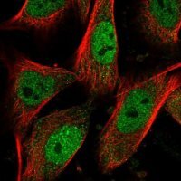 Anti-PHC2 antibody produced in rabbit 