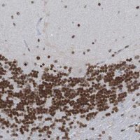 Anti-PHF2 antibody produced in rabbit 
