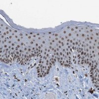 Anti-PHF2 antibody produced in rabbit 