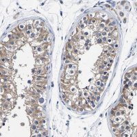 Anti-PHF24 antibody produced in rabbit 