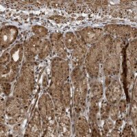 Anti-PHIP antibody produced in rabbit 