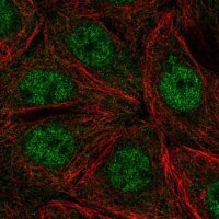 Anti-PHKA2 antibody produced in rabbit 
