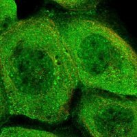 Anti-PHLDB3 antibody produced in rabbit 