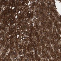Anti-PI4KB antibody produced in rabbit