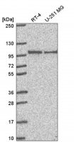 Anti-PIBF1 antibody produced in rabbit 