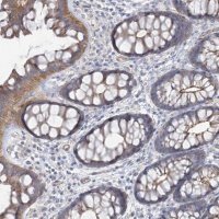 Anti-PIGC antibody produced in rabbit HPA036663-100UL