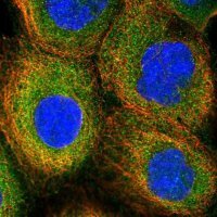 Anti-PIGN antibody produced in rabbit 