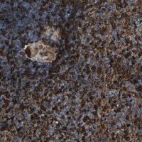 Anti-PIGS antibody produced in rabbit HPA018149-100UL