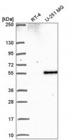Anti-PIP4K2B antibody produced in rabbit 