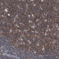 Anti-PIP5K1A antibody produced in rabbit 