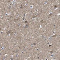 Anti-PIP5K1C antibody produced in rabbit 