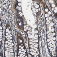 Anti-PIP5K1C antibody produced in rabbit 
