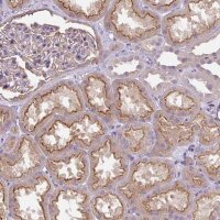 Anti-PIP5KL1 antibody produced in rabbit 