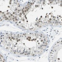 Anti-PITHD1 antibody produced in rabbit 