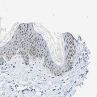 Anti-PITHD1 antibody produced in rabbit 