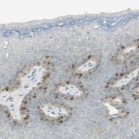 Anti-PITX1 antibody produced in rabbit