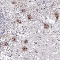 Anti-PITX3 antibody produced in rabbit 