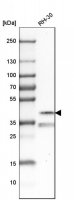 Anti-PITX3 antibody produced in rabbit 