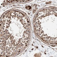 Anti-PKD1L1 antibody produced in rabbit 