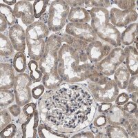 Anti-PKD2 antibody produced in rabbit 