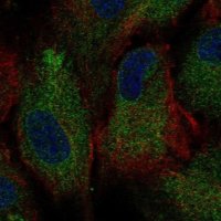 Anti-PKD2 antibody produced in rabbit 