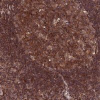 Anti-PKD2L2 antibody produced in rabbit 