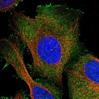 Anti-PKD2L2 antibody produced in rabbit 