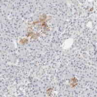 Anti-PKDCC antibody produced in rabbit 