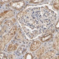 Anti-PKN1 antibody produced in rabbit 