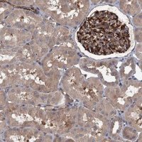 Anti-PKN2 antibody produced in rabbit 