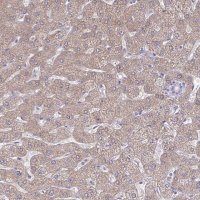 Anti-PLA2G12B antibody produced in rabbit