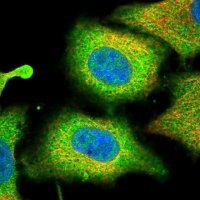 Anti-PLA2G4A antibody produced in rabbit 