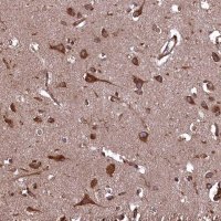 Anti-PLA2G4C antibody produced in rabbit 