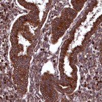 Anti-PLA2G4C antibody produced in rabbit 
