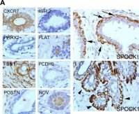 Anti-PLAT antibody produced in rabbit 