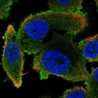 Anti-PLCB2 antibody produced in rabbit 