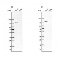 Anti-PLCG2 antibody produced in rabbit 