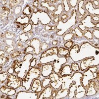Anti-PLIN2 antibody produced in rabbit 