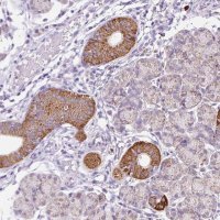 Anti-PLPP2 antibody produced in rabbit 