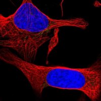 Anti-PLPP2 antibody produced in rabbit 